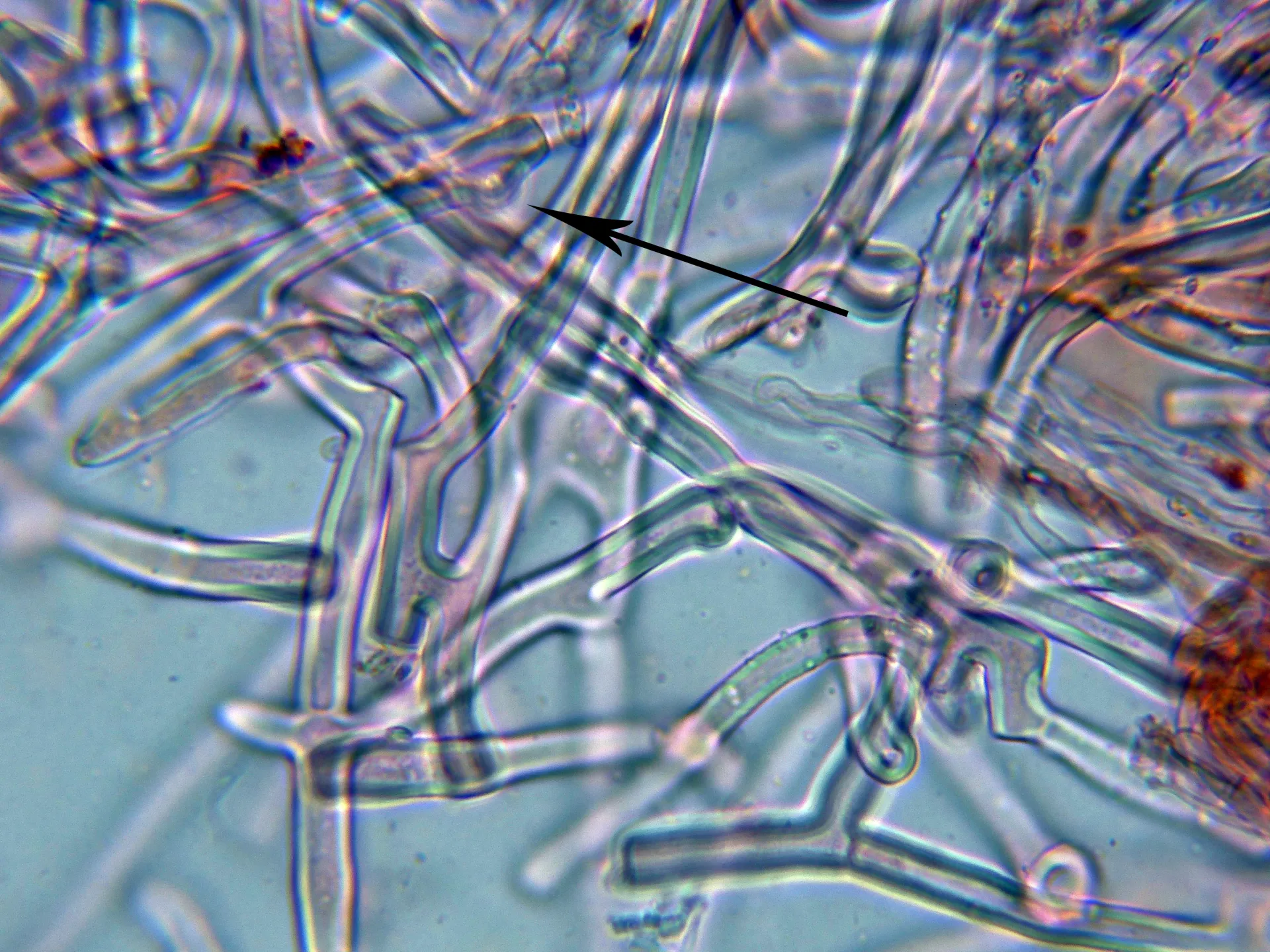 Microscopía de Phanerochaete laevis - 10 - Hifas subiculares-004